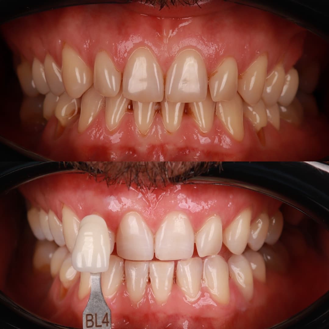 Digital dental technology and precision clinical instruments